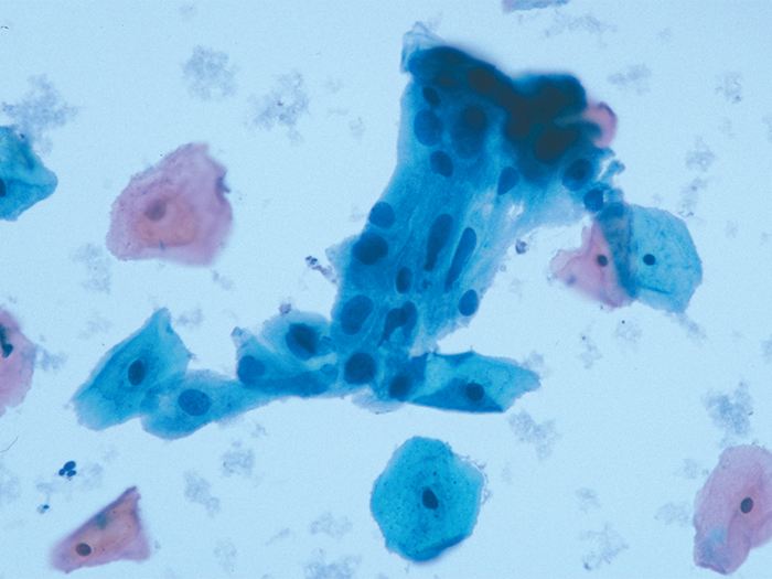 EA Stains, Series S