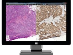 Epredia medical grade monitor for digital pathology whole slide scanner