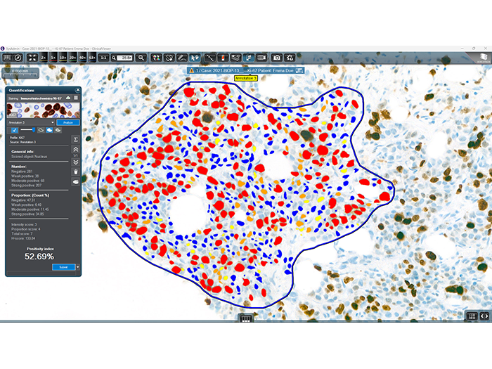 3DHISTECH QuantCenter Software
