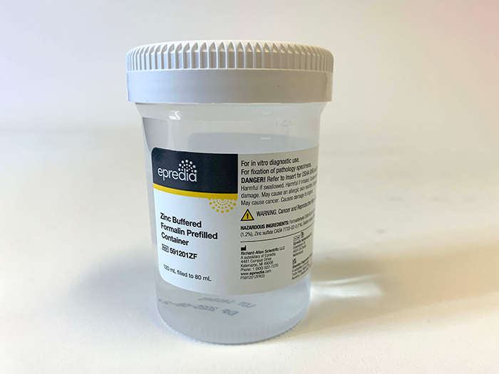 Zinc Formalin Prefilled Containers in Trays