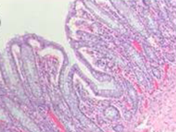 Revos Clinical Brief Image