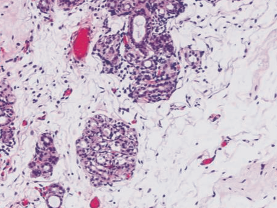 Revos Clinical Brief Image